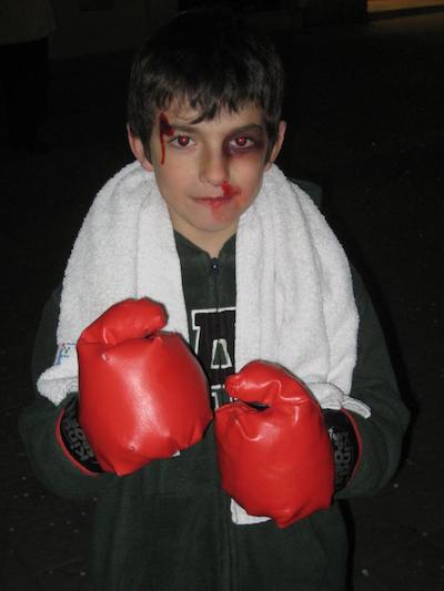 Atenci�, boxejador lessionat
